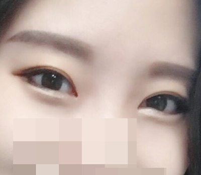 퍼펙트빅아이 짱짱맨><b