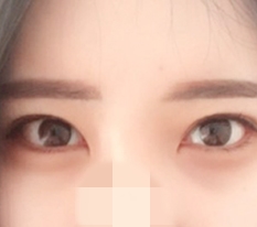 뒤트임이랑 밑트임!