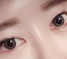 트임 재수술 함 ~.~ 현대미학 ㅇㅈ ♡♡