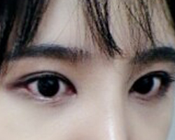 눈 예뻐영