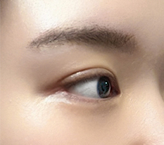 사나운눈과 결별