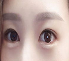 자연유착+뒤밑틤 4갤째