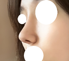 코끝 디테일 굿
