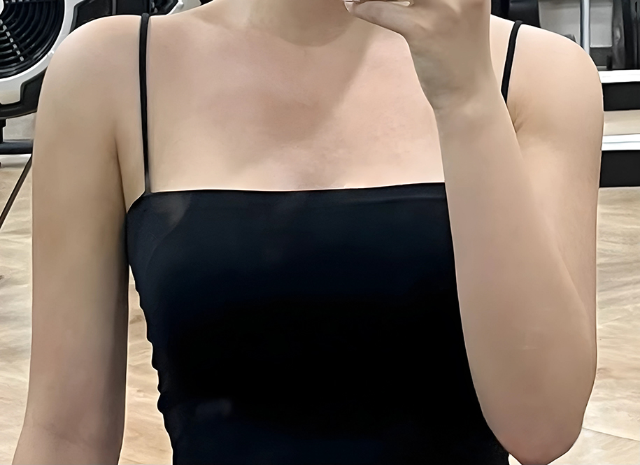 뼈팔 지흡 성공💗 팔/겨드랑이/브라라인/견갑/부유방