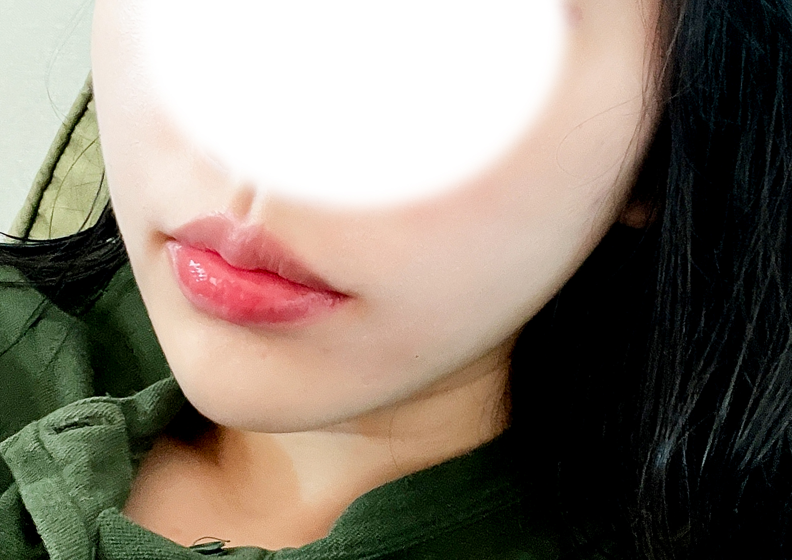큐피트라인 너무 예쁘게 됐어요!!