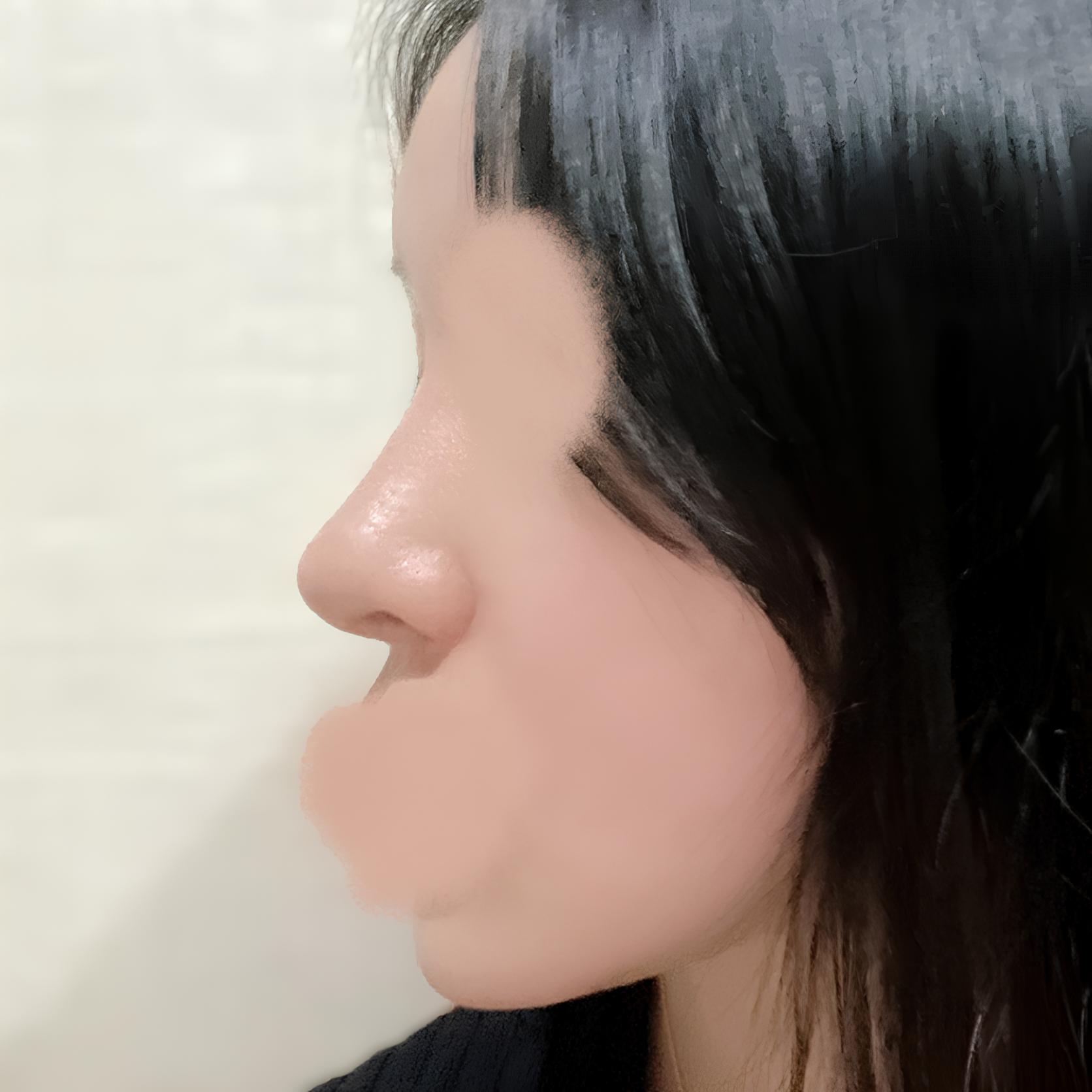 복코에서 얄쌍한 직반코로
