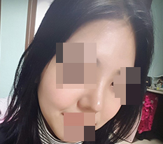 짧고 뚱뚱한 복코 현대미학에서 예쁘게 바꿔줬어요^_^
