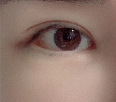 다행히 좋은 결과 나왔어용