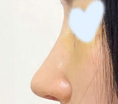 너무 잘한 것 같고 속이 후련해요
