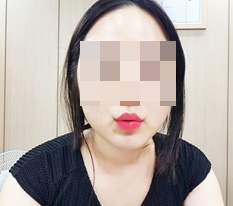 입꼬리후기남깁니당!!