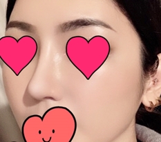 재수술 후기 남겨요오~*_*