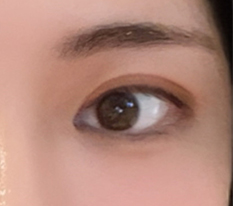 수술 잘됐습니다