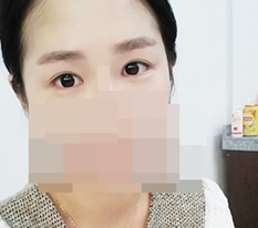 왕눈이된후기쓰~ㅇ_ㅇ