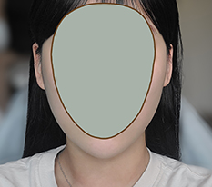 얼굴라인 달라졌죠?