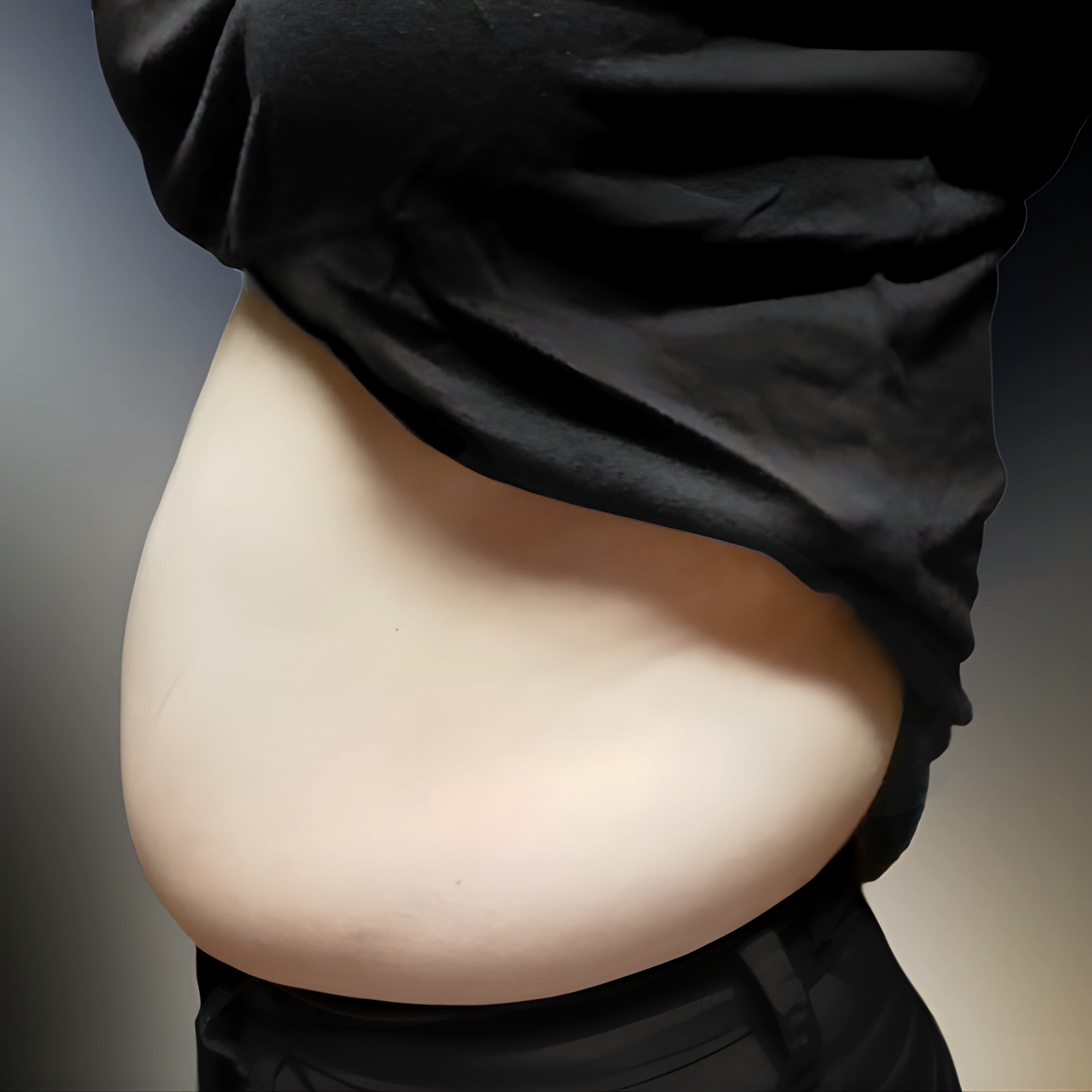 복부지방 썰고 왔어용 #러브핸들 #옆구리 #뒷구리 #복부