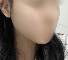 얼굴 갸름해졌오용!!