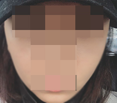 광대축소 하니까 인상이 완전 달라지네용♥