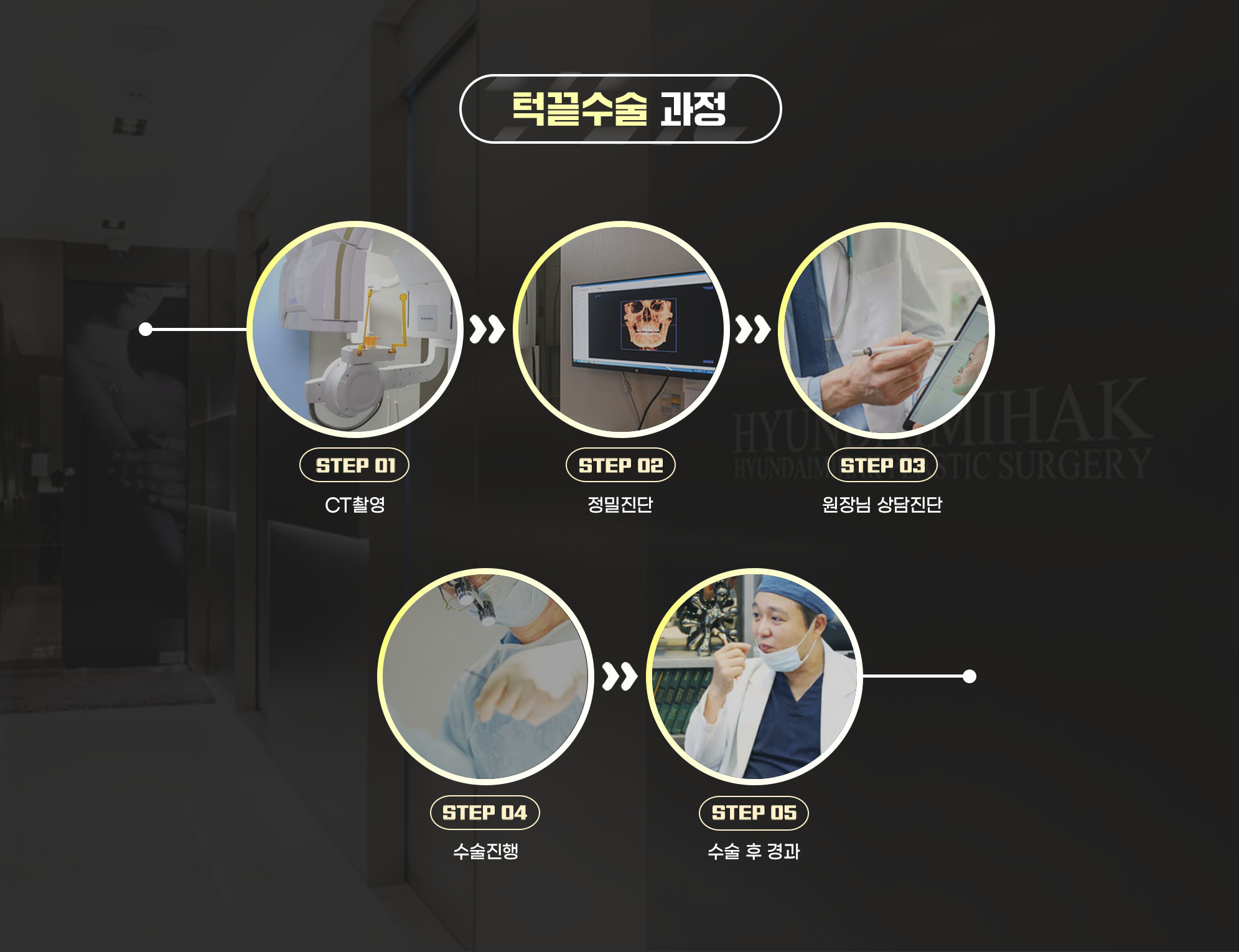 턱끝수술 과정 — STEP 01 CT촬영, STEP 02 정밀진단, STEP 03 원장님 상담진단, STEP 04 수술진행, STEP 05 수술 후 경과