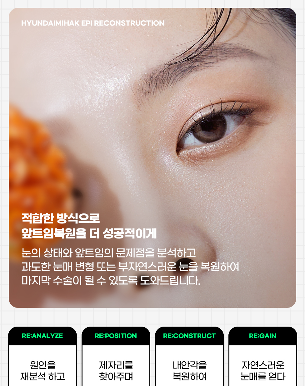 EPI RECONSTRUCTION — 적합한 방식으로 앞트임복원을 더 성공적이게: 원인을 정밀하게 분석(Re:Analyze), 재건 방식을 찾아주는(Re:Position), 내안각 복원(Re:Construct), 자연스러운 눈매를 얻다(Re:Gain)