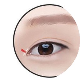 앞트임 3단계 — 불필요한 피부 제거