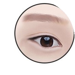 뒤트임 1단계 — 답답하게 막혀 올라간 눈매