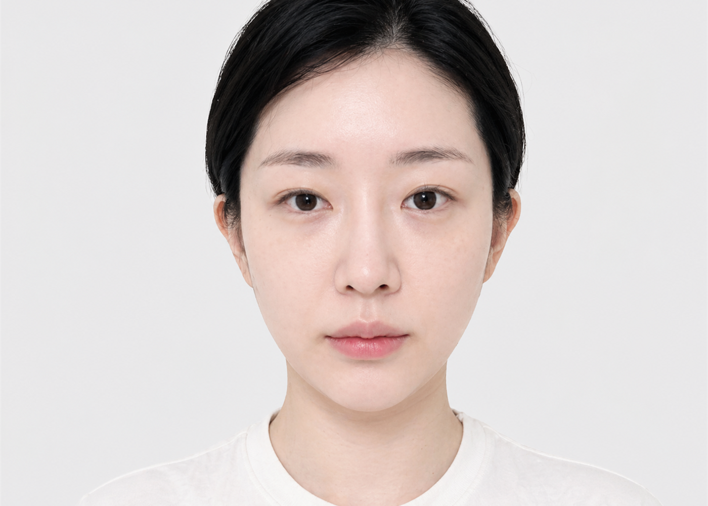 자연스러운 눈매교정 before