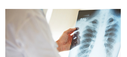 X-Ray 검사