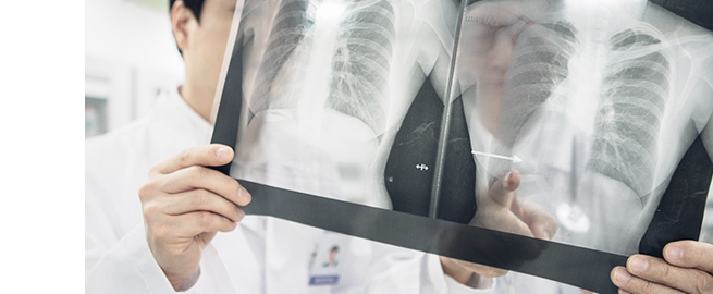수술 전 검사를 통한 안전한 마취 준비 (X-Ray)