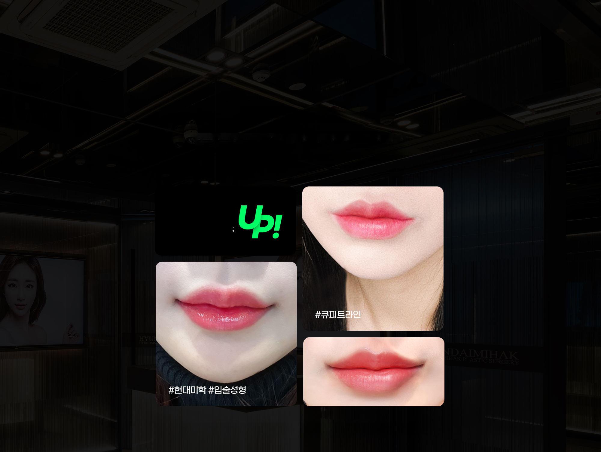 큐피트라인 입술성형 전후 입술 사진