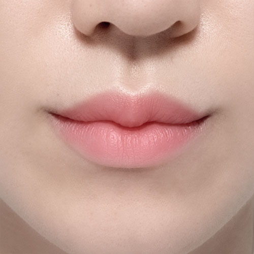 노필러 예쓰성형