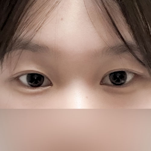 짝짝이눈 탈출ㅠㅠㅠㅠㅠㅠㅠ
