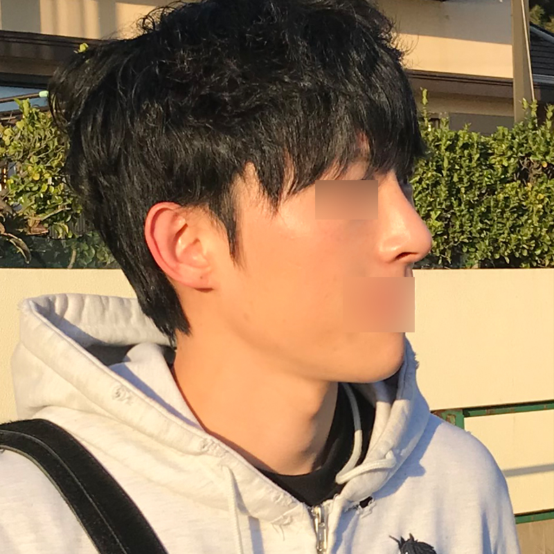 전후가 그냥 달라요.