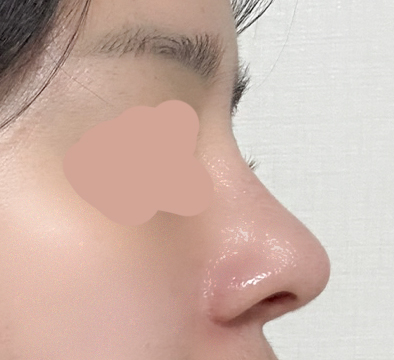 이젠 정말 마지막 코재..