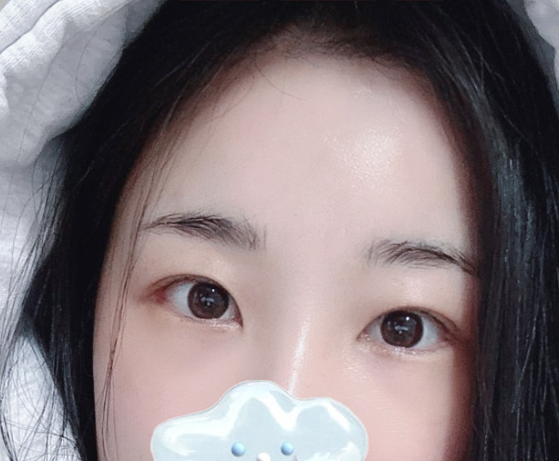 이마거상하길 잘했어요