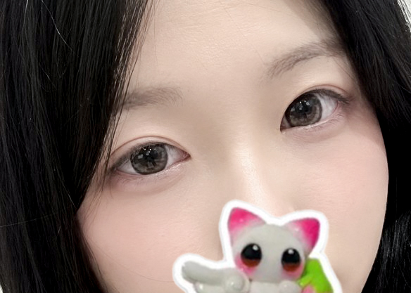고민하다가 결국 눈 성형했어요